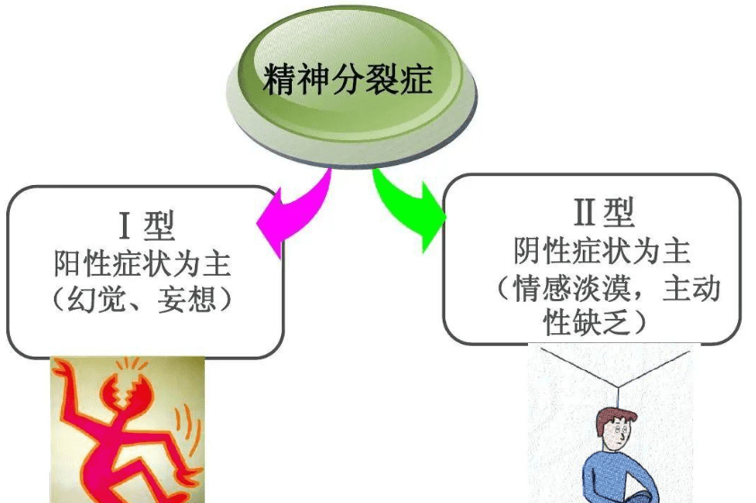 緊張型精神分裂症症狀
