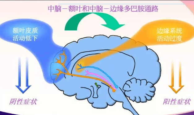 緊張型精神分裂症原因